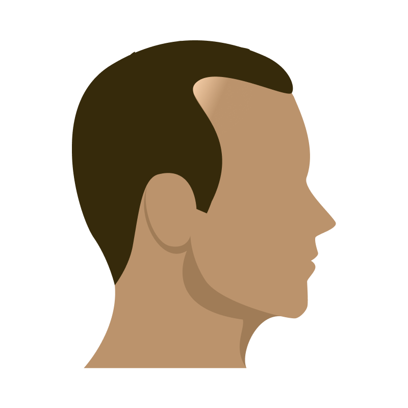 Hairline