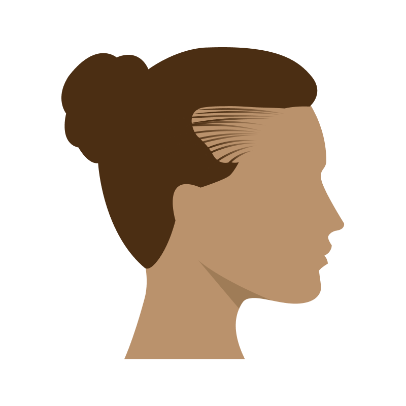 Hairline